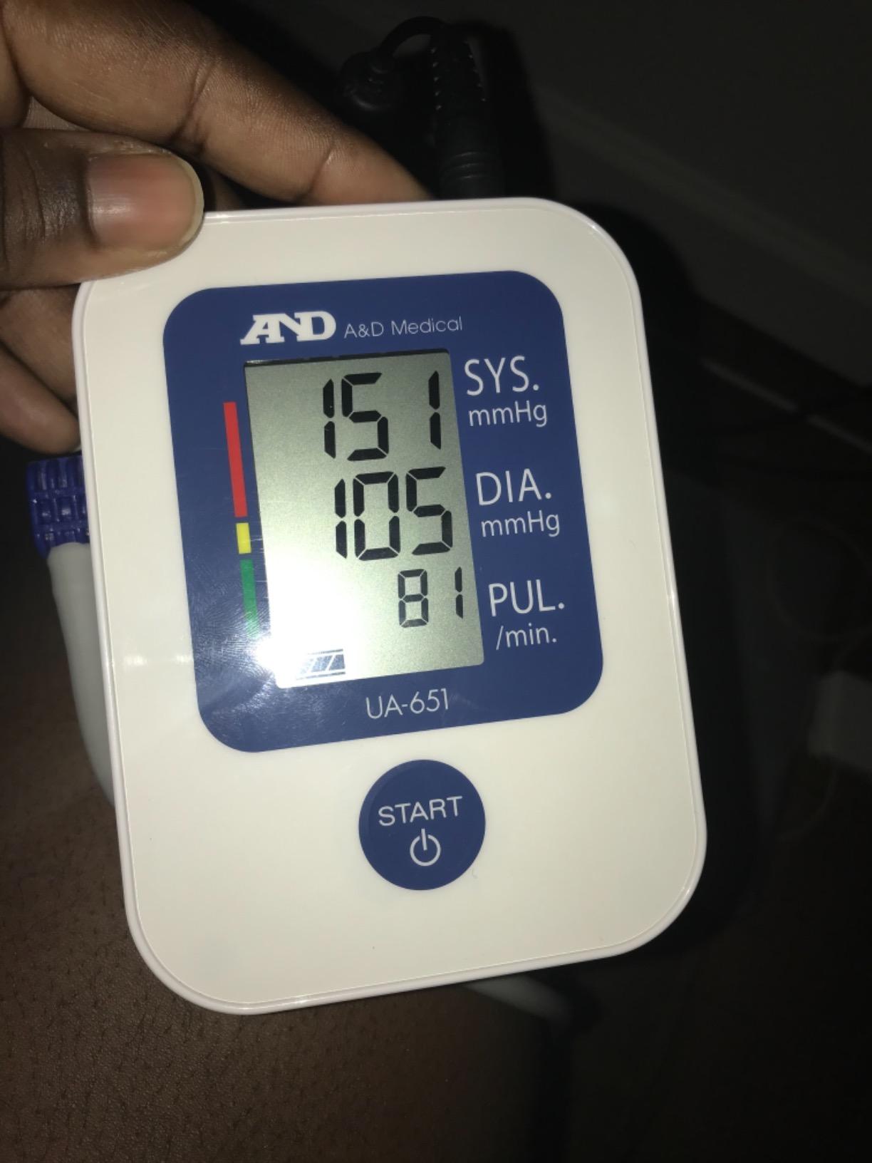 A&D Medical Blood Pressure Monitor for Home Use, UA-651 - Upper Arm Precise BP Machine - Wide Range Cuff (8.6-16.5