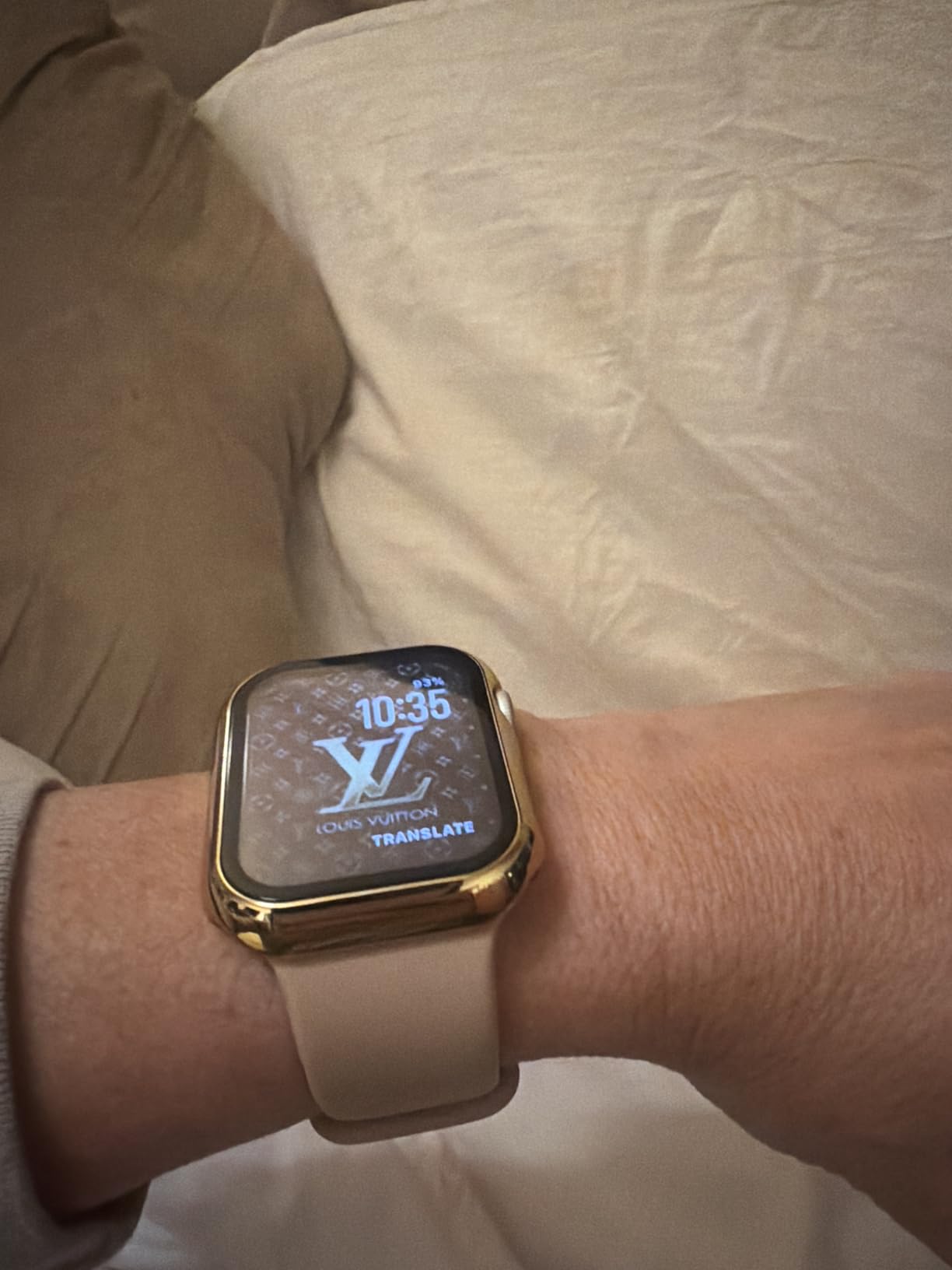 Apple Watch SE 3 [GPS 40mm] Smartwatch with Starlight Aluminum Case - Fitness and Sleep Trackers customer photo 1