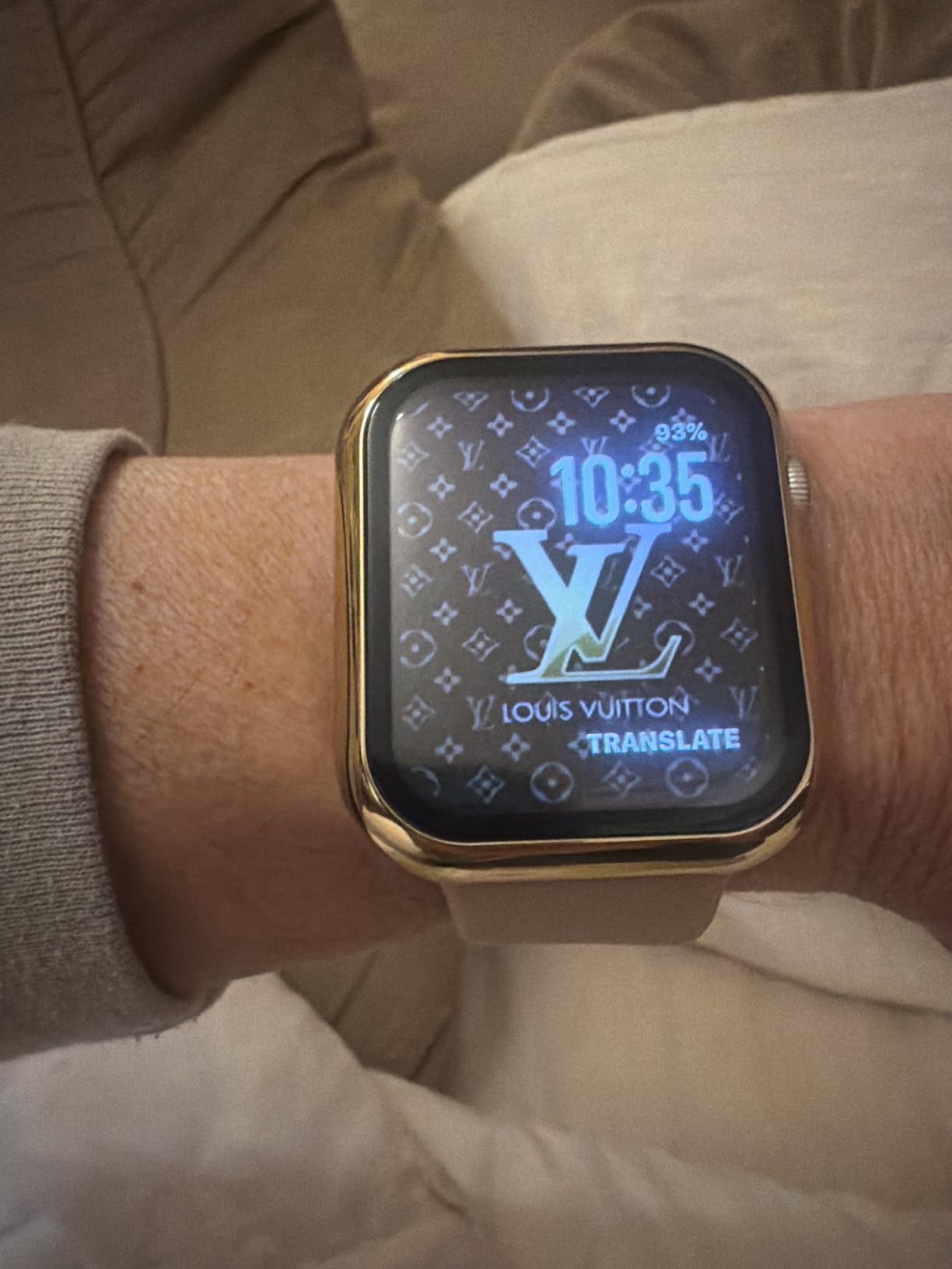 Apple Watch SE 3 [GPS 40mm] Smartwatch with Starlight Aluminum Case - Fitness and Sleep Trackers customer photo 2