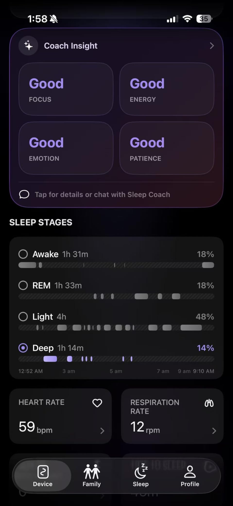 OZI Smart Sleep Tracker, Non-Wearable Contactless Under-Sheet Sleep Monitor | No Monthly Fees, Tracks Sleep Stages, Heart Rate, Breathing, Movement customer photo 1