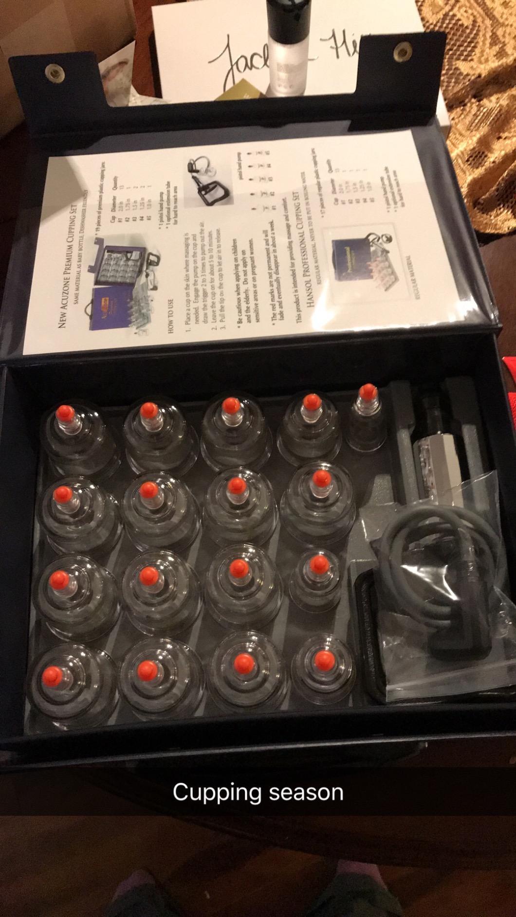 Professional Cupping Set *Made in Korea* (17 Cups) with Extension Tube($3.00 Value) KS Choi Corp