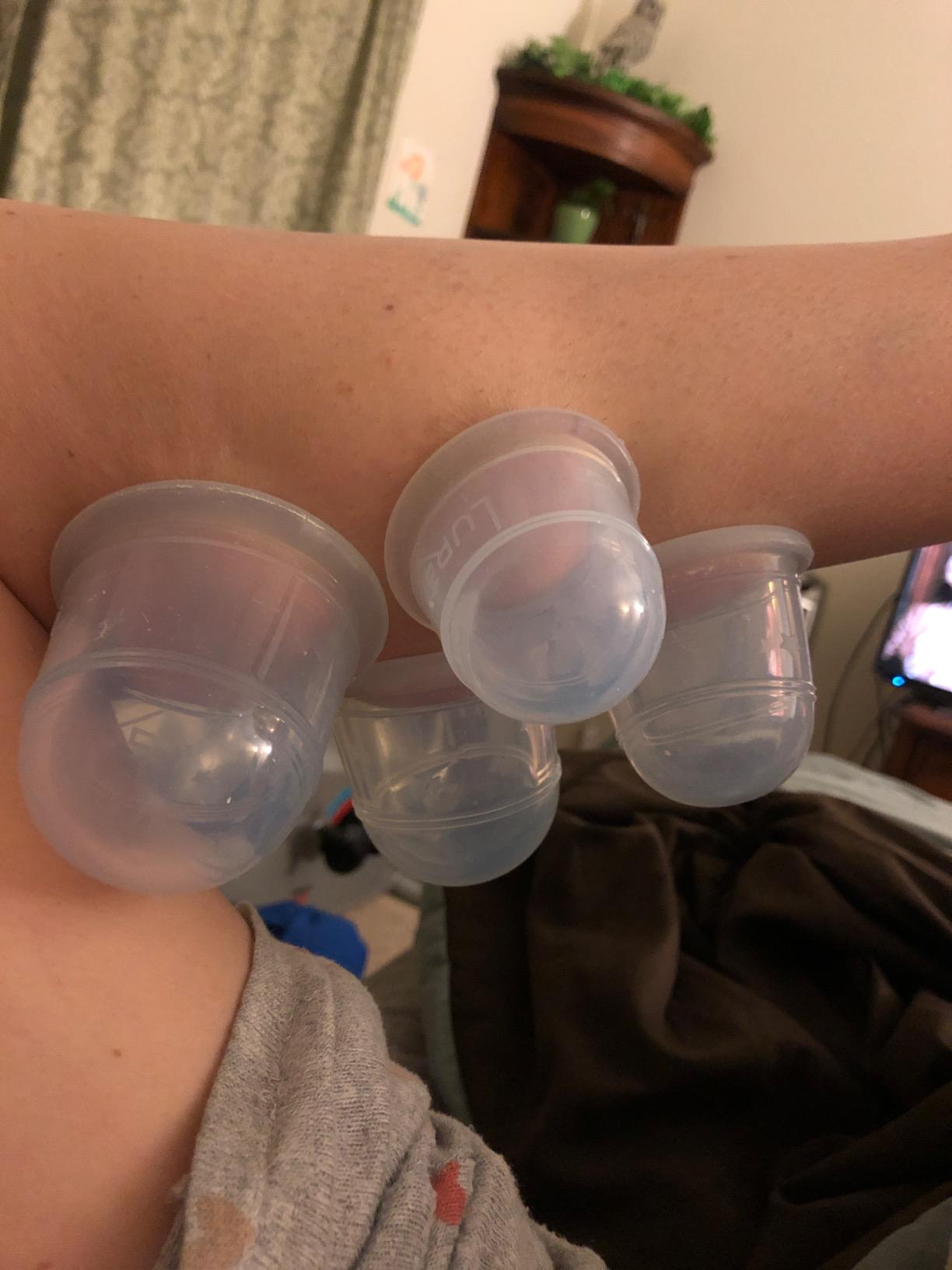 Silicone Cupping Therapy Set 6 Professional Massage Cupping Cups customer photo 1