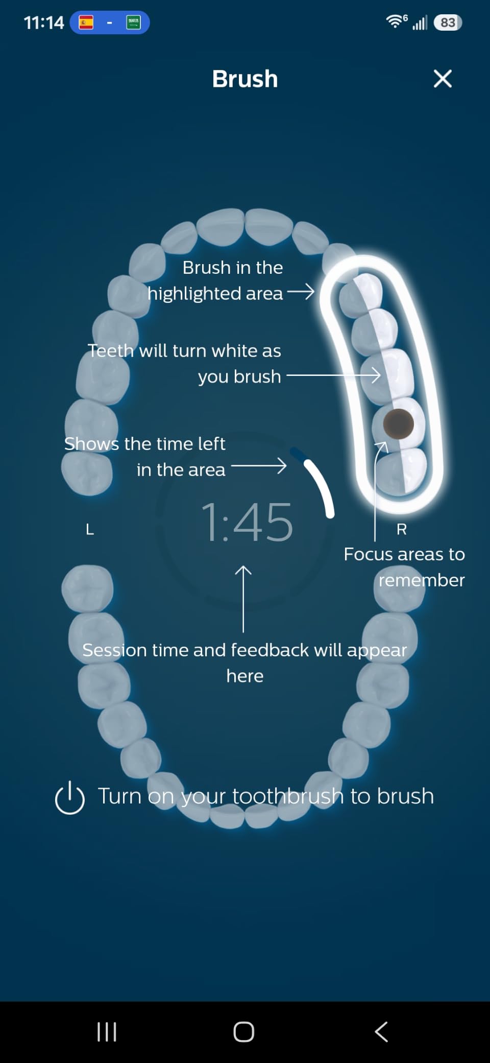 Philips Sonicare DiamondClean 9500 Electric Toothbrush 3 Brush Heads, Gray customer photo 2